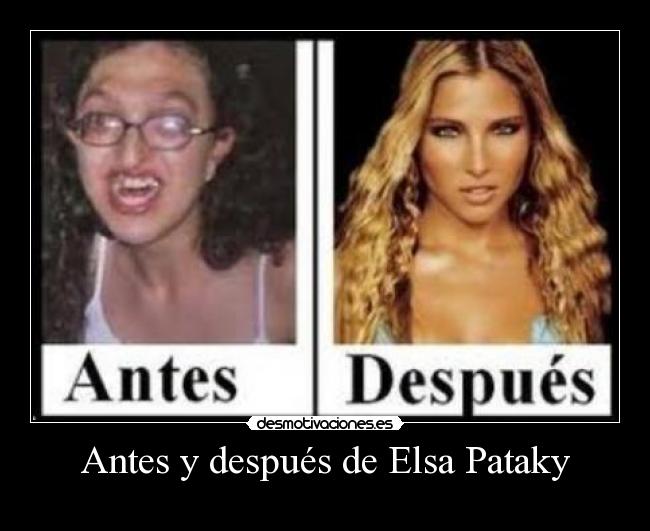 Antes y después de Elsa Pataky -