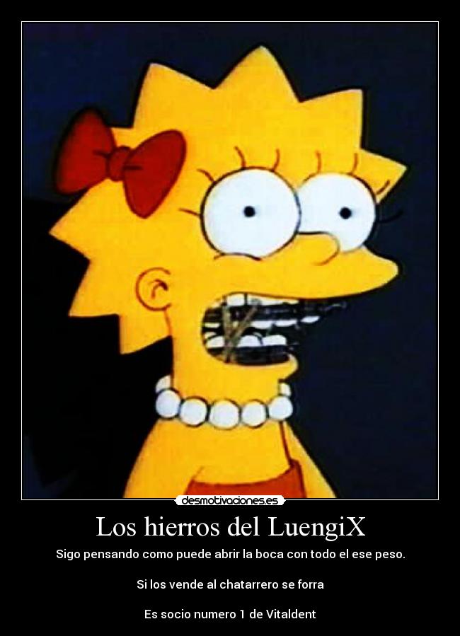 Los hierros del LuengiX - Sigo pensando como puede abrir la boca con todo el ese peso.
Si los vende al chatarrero se forra
Es socio numero 1 de Vitaldent