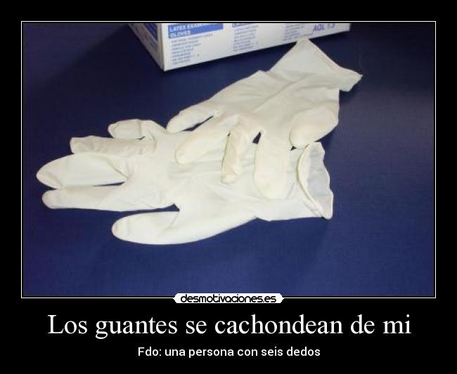 Los guantes se cachondean de mi - 