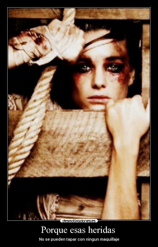 Porque esas heridas  - No se pueden tapar con ningun maquillaje