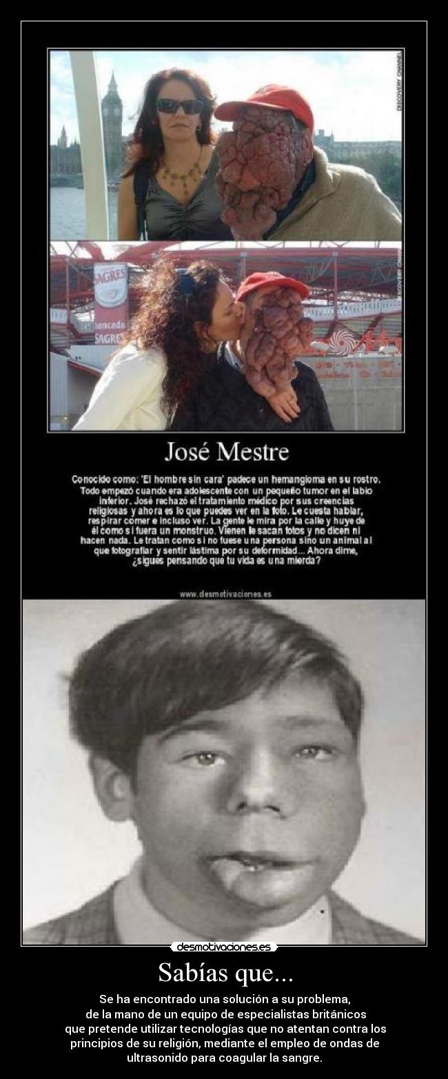 Sabías que... - Se ha encontrado una solución a su problema,
 de la mano de un equipo de especialistas británicos
 que pretende utilizar tecnologías que no atentan contra los
principios de su religión, mediante el empleo de ondas de
ultrasonido para coagular la sangre.