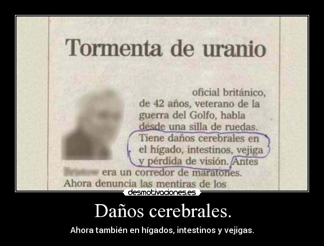 Daños cerebrales. - 