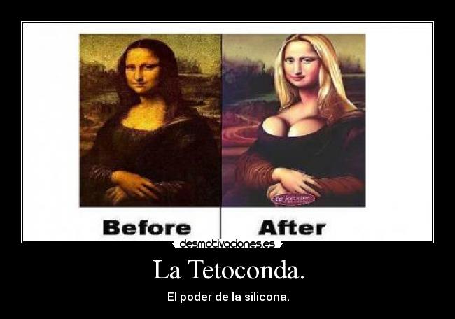 La Tetoconda. -