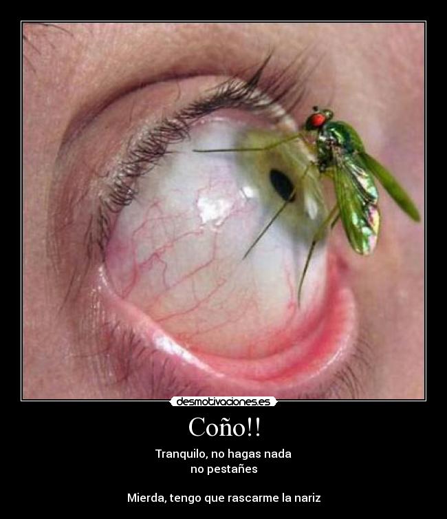 Coño!! - Tranquilo, no hagas nada
no pestañes
Mierda, tengo que rascarme la nariz