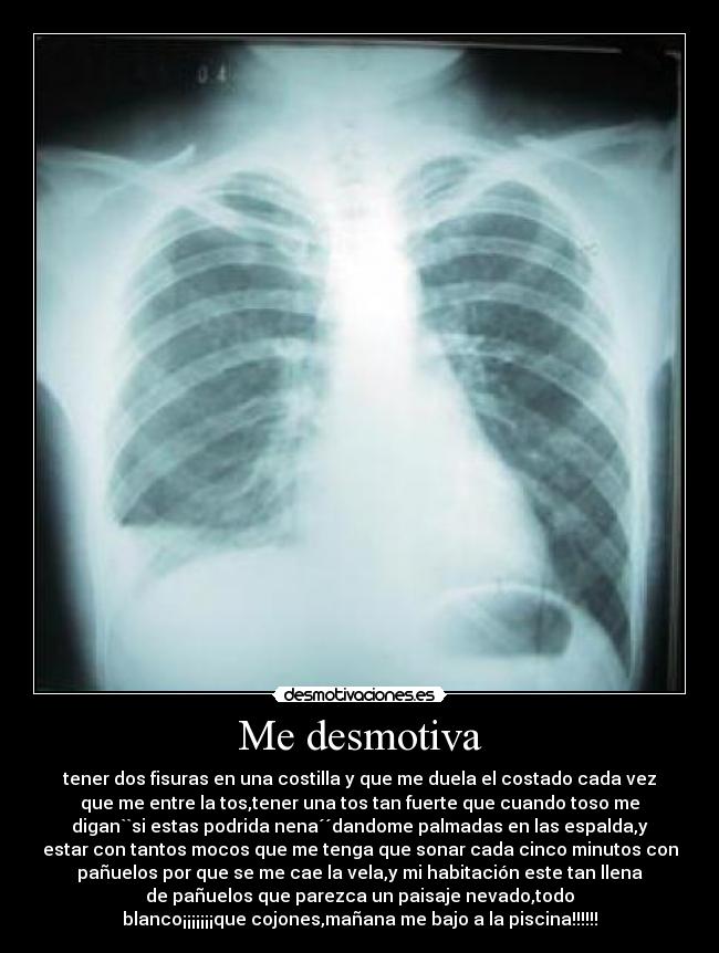 Me desmotiva - tener dos fisuras en una costilla y que me duela el costado cada vez
que me entre la tos,tener una tos tan fuerte que cuando toso me
digan``si estas podrida nena´´dandome palmadas en las espalda,y
estar con tantos mocos que me tenga que sonar cada cinco minutos con
pañuelos por que se me cae la vela,y mi habitación este tan llena
de pañuelos que parezca un paisaje nevado,todo
blanco¡¡¡¡¡¡¡que cojones,mañana me bajo a la piscina!!!!!!