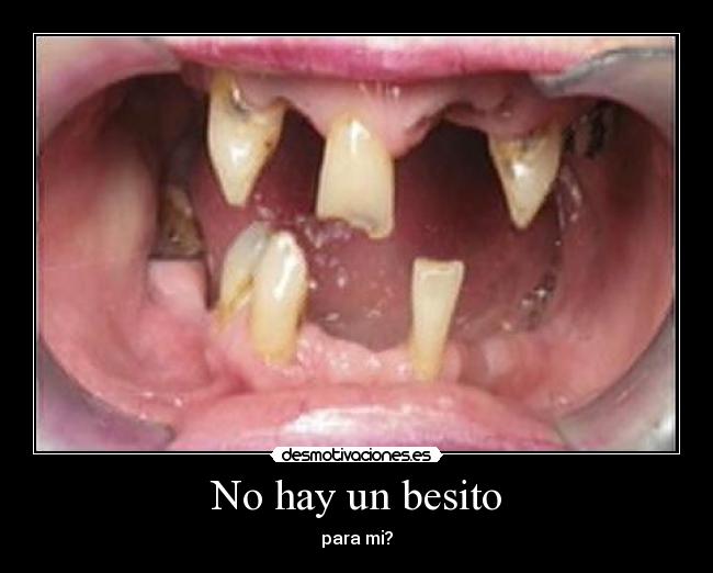 No hay un besito - 