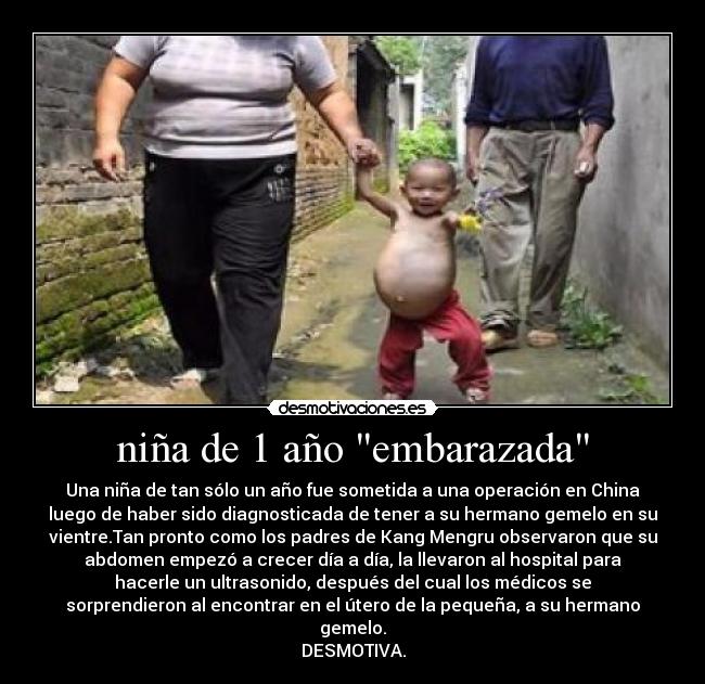 niña de 1 año embarazada -