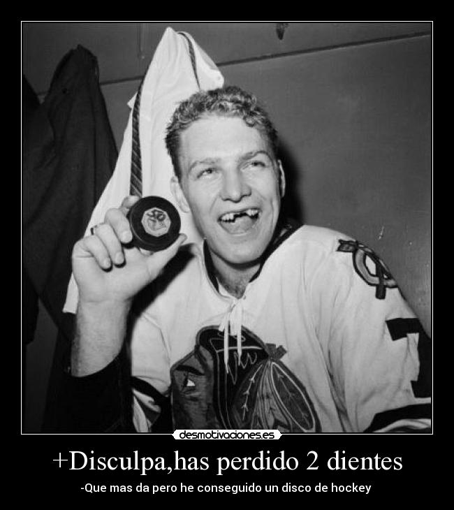 +Disculpa,has perdido 2 dientes -