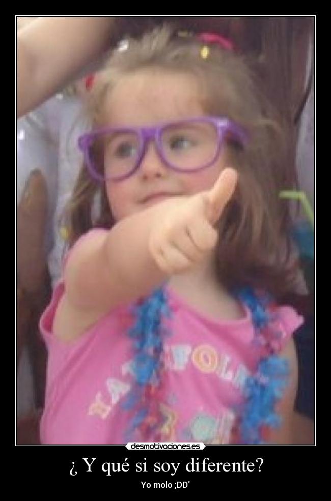 ¿ Y qué si soy diferente? - Yo molo ;DD