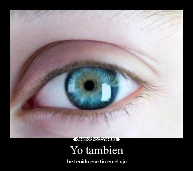 Yo tambien - 