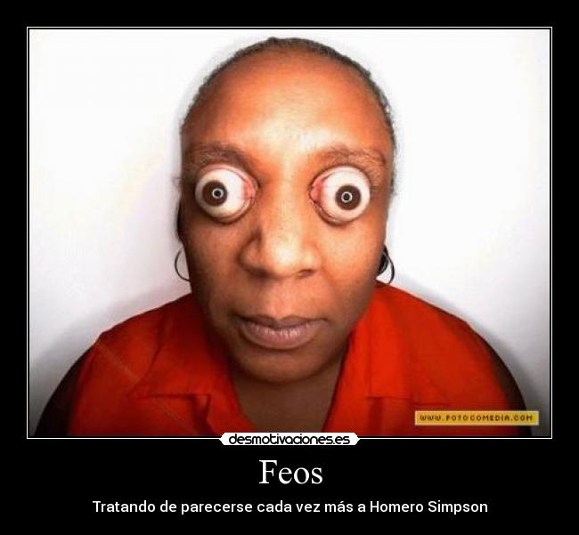 Feos - Tratando de parecerse cada vez más a Homero Simpson