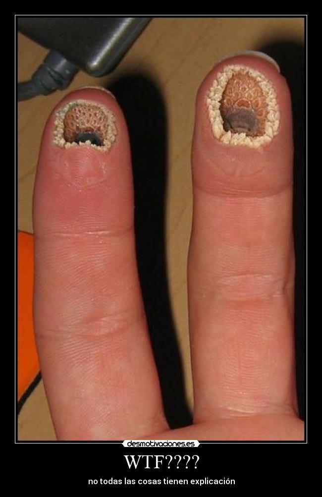 WTF???? - no todas las cosas tienen explicación