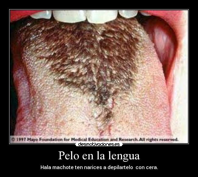 Pelo en la lengua -