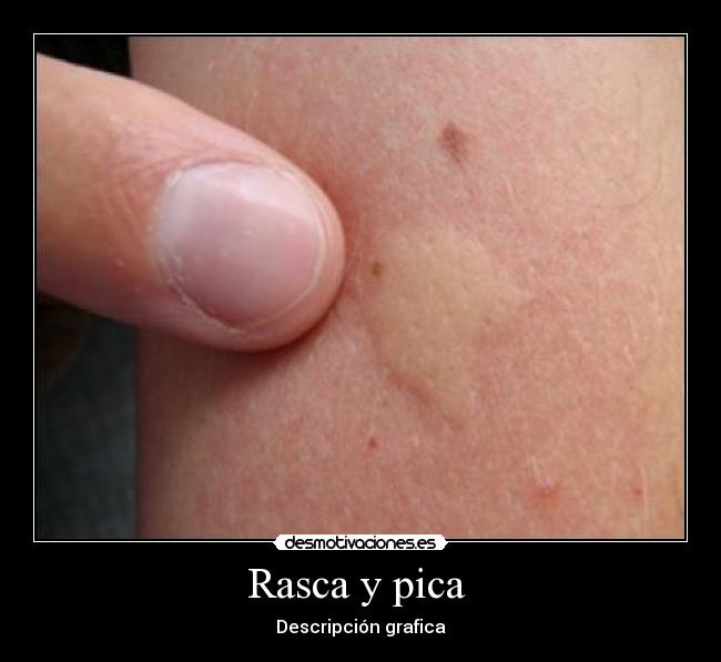 Rasca y pica -