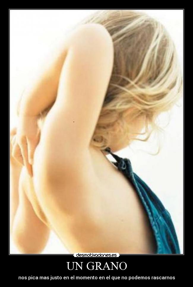 UN GRANO - nos pica mas justo en el momento en el que no podemos rascarnos
