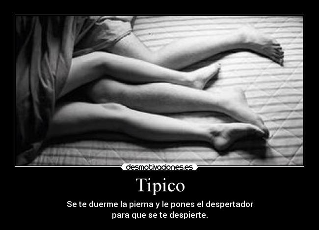 Tipico - Se te duerme la pierna y le pones el despertador
para que se te despierte.