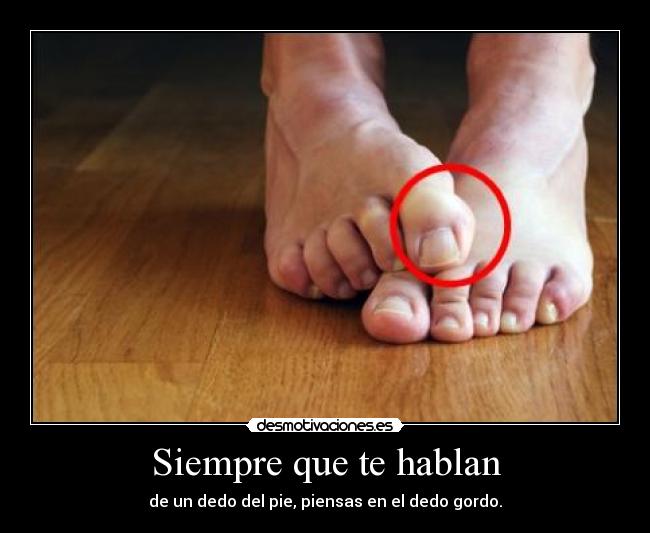 Siempre que te hablan - de un dedo del pie, piensas en el dedo gordo.