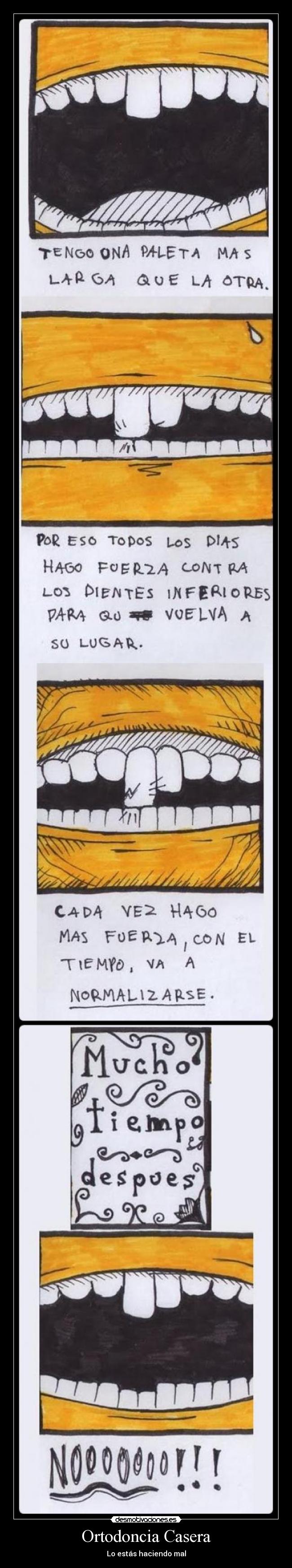 Ortodoncia Casera - 