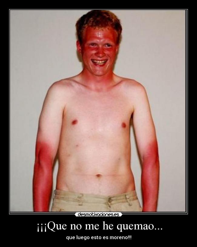 ¡¡¡Que no me he quemao... - que luego esto es moreno!!!