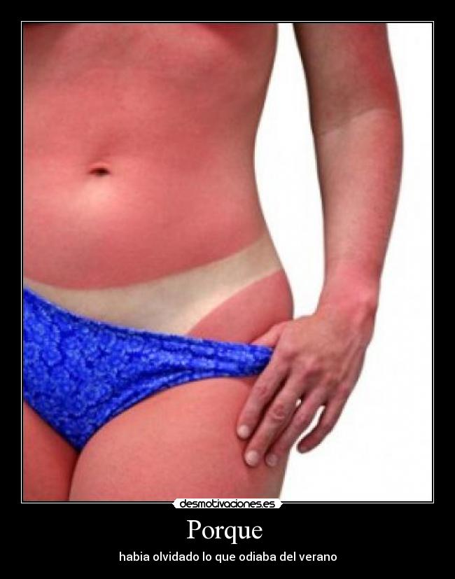 Porque  - habia olvidado lo que odiaba del verano
