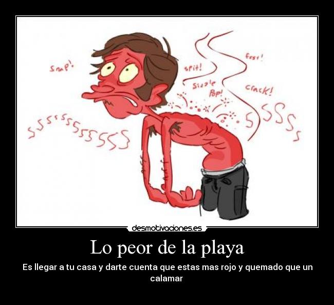 Lo peor de la playa - Es llegar a tu casa y darte cuenta que estas mas rojo y quemado que un calamar