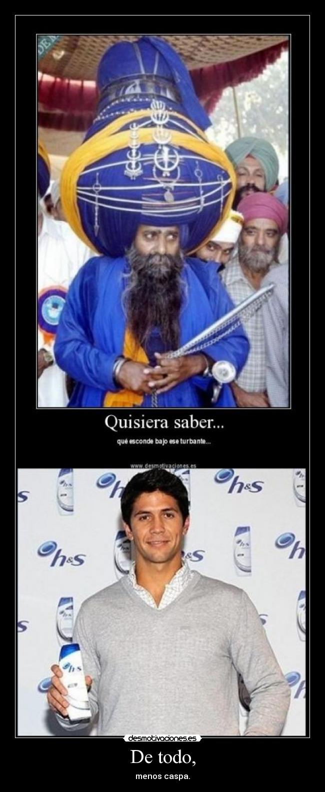 De todo, - menos caspa.