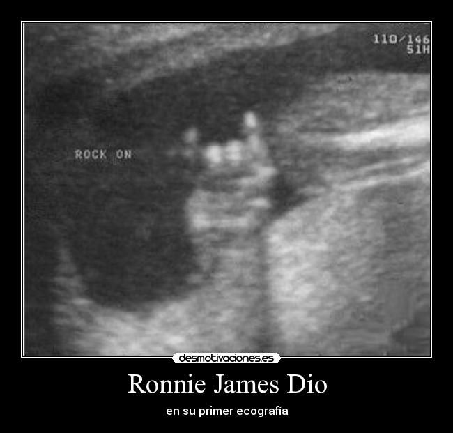 Ronnie James Dio - en su primer ecografía