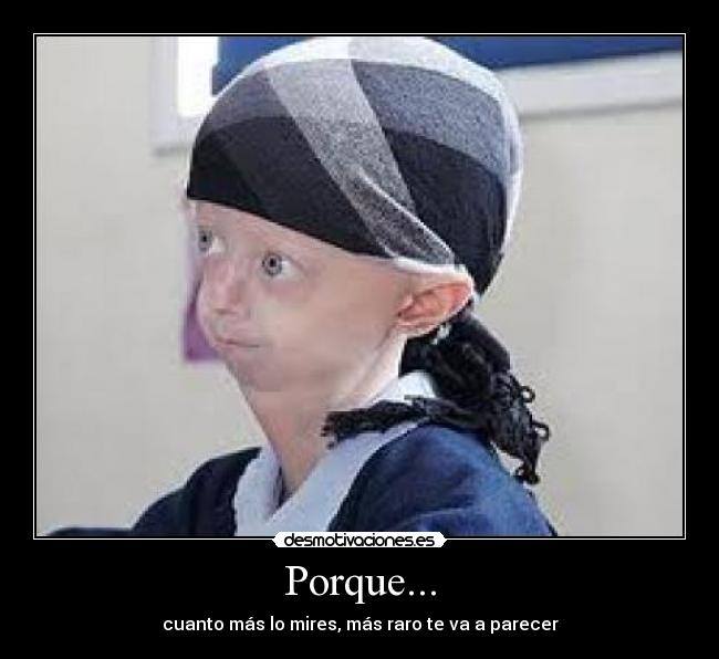 Porque... - cuanto más lo mires, más raro te va a parecer