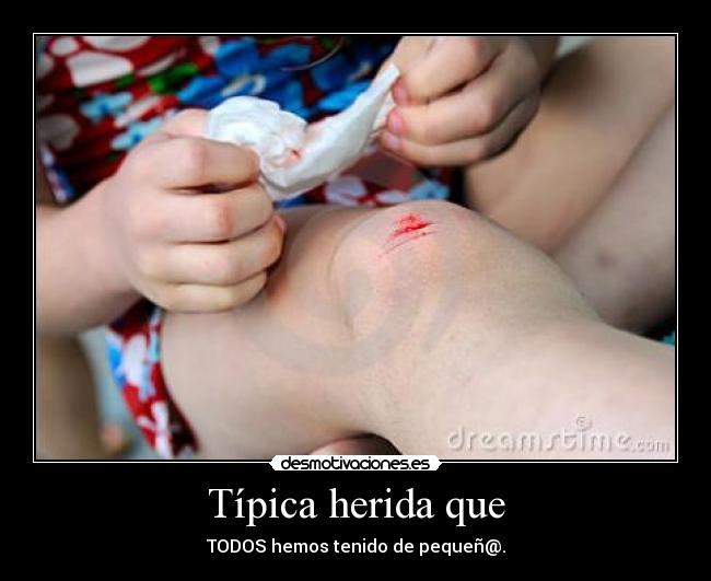 Típica herida que - TODOS hemos tenido de pequeñ@.