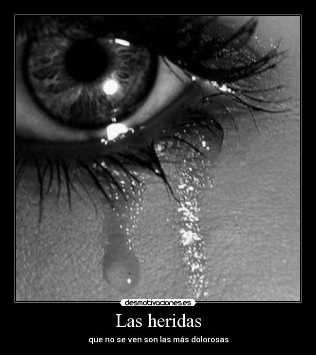 Las heridas -