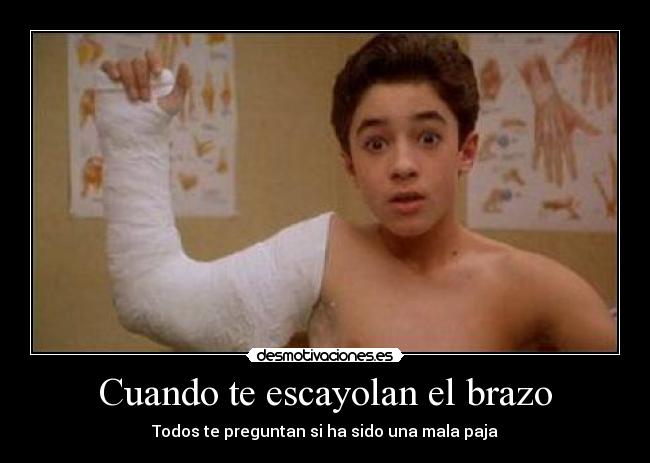 Cuando te escayolan el brazo - Todos te preguntan si ha sido una mala paja