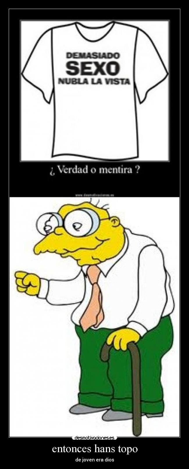 entonces hans topo -