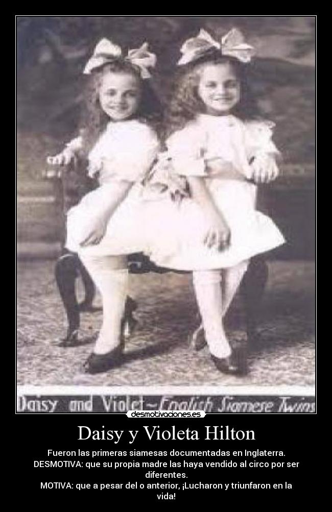 Daisy y Violeta Hilton -