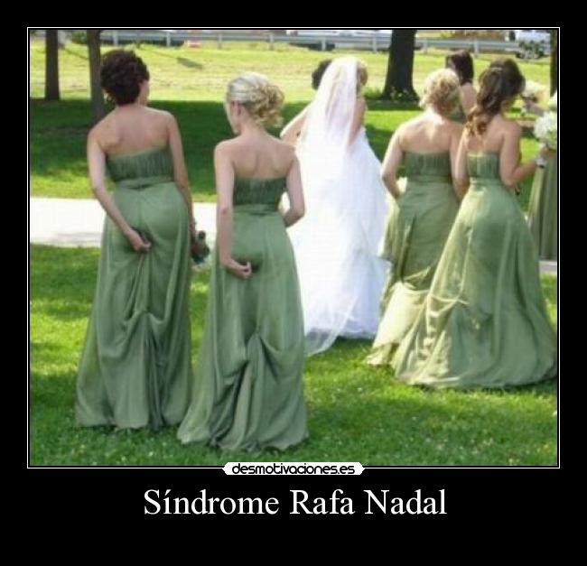 Síndrome Rafa Nadal - 