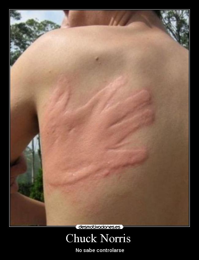 Chuck Norris  - 
