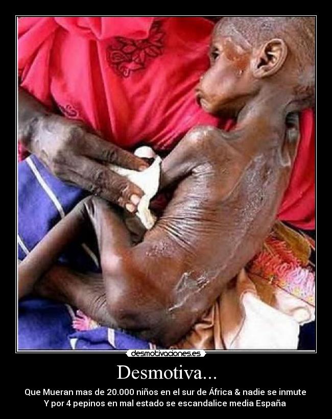 Desmotiva... - Que Mueran mas de 20.000 niños en el sur de África & nadie se inmute
Y por 4 pepinos en mal estado se escandalice media España