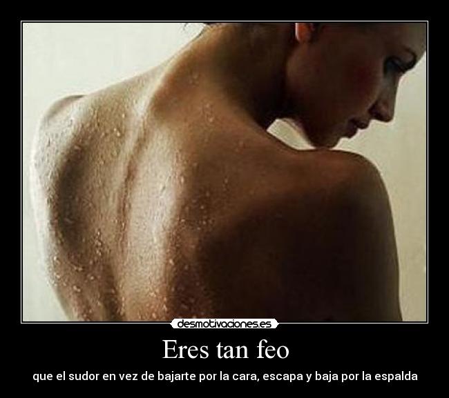 Eres tan feo - que el sudor en vez de bajarte por la cara, escapa y baja por la espalda