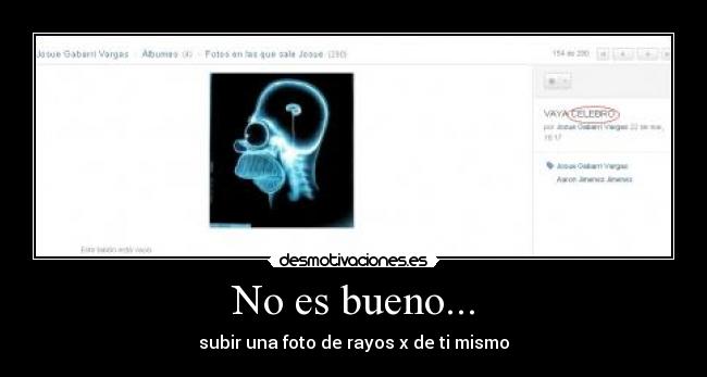 No es bueno... - subir una foto de rayos x de ti mismo