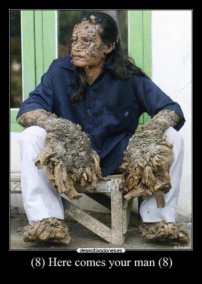 (8) Here comes your man (8) -