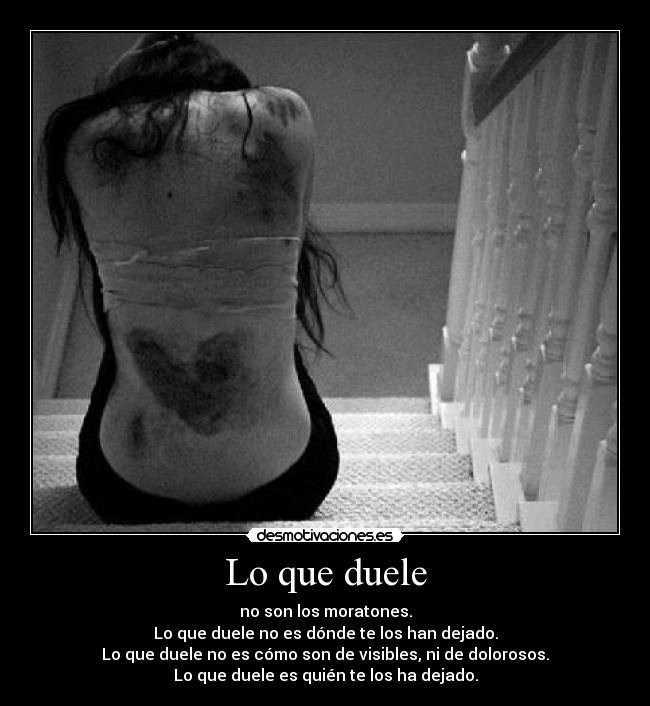 Lo que duele - 