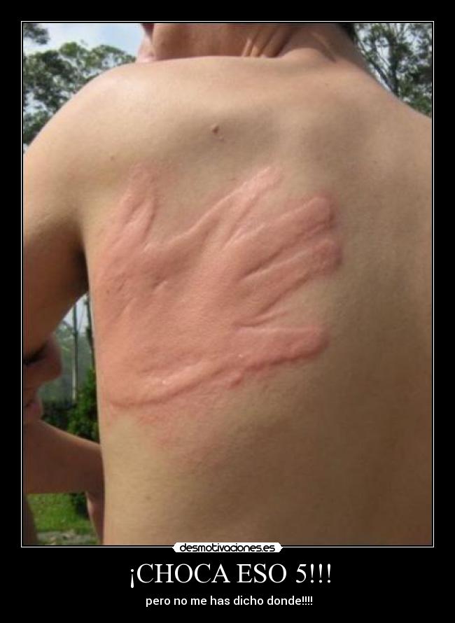 ¡CHOCA ESO 5!!! - 
