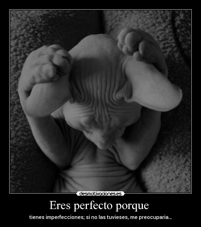 Eres perfecto porque - tienes imperfecciones; si no las tuvieses, me preocuparia…