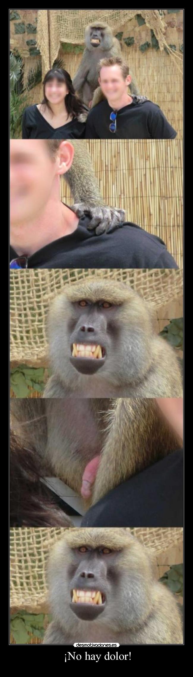 ¡No hay dolor! - 