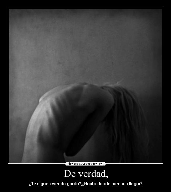 carteles anorexia desmotivaciones