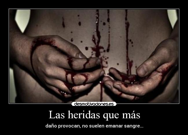 Las heridas que más -