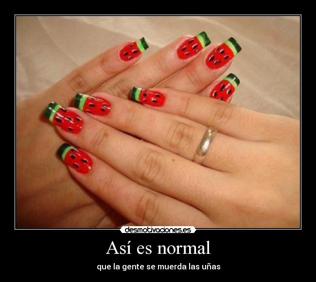 Así es normal -