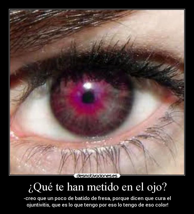 ¿Qué te han metido en el ojo? - -creo que un poco de batido de fresa, porque dicen que cura el
ojuntivitis, que es lo que tengo por eso lo tengo de eso color!