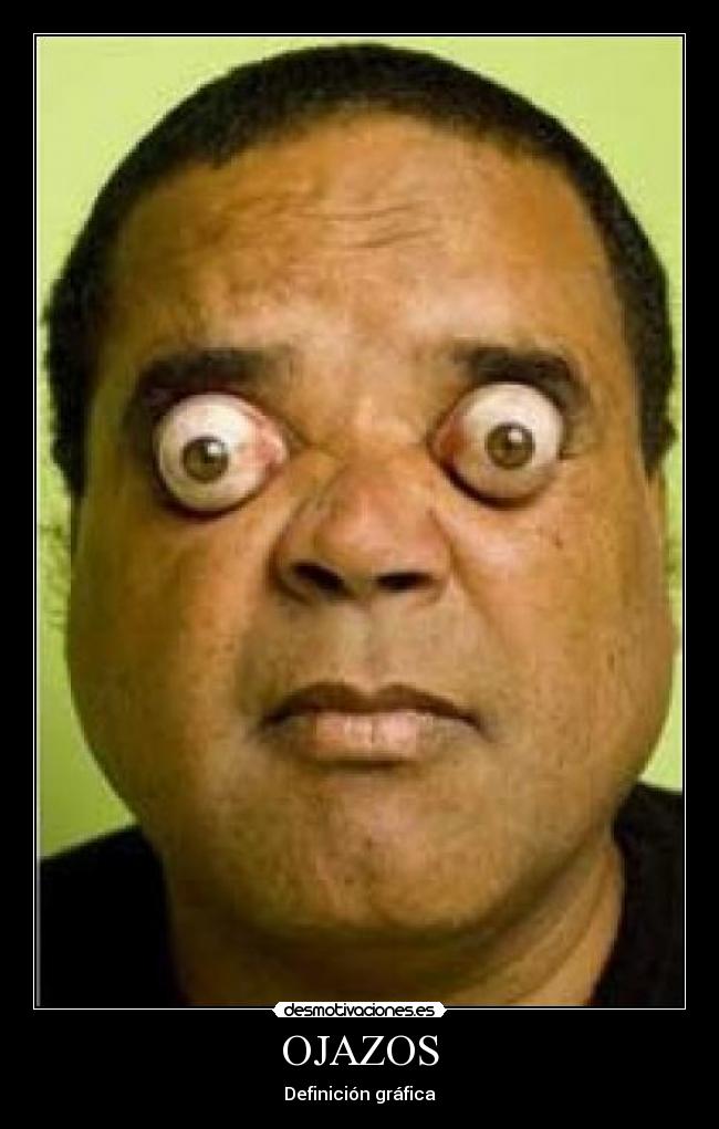 Imagenes Ojos Saltones | im 225 genes y carteles de saltones pag 2 desmotivaciones Imagenes Ojos Saltones | im 225 genes y carteles de saltones pag 2 desmotivaciones