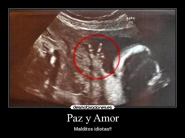 Paz y Amor - Malditos idiotas!!