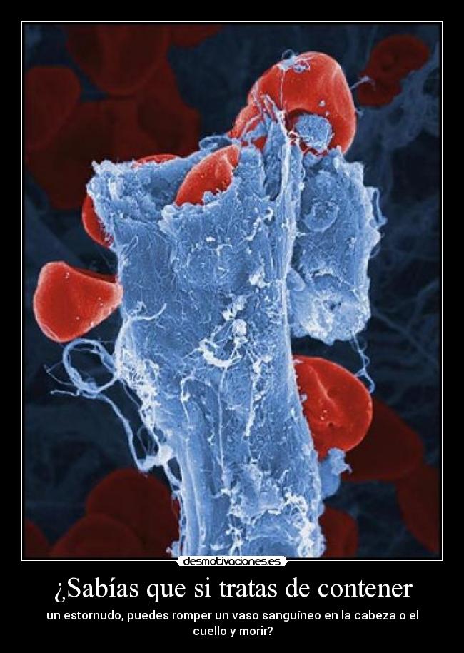 ¿Sabías que si tratas de contener - 